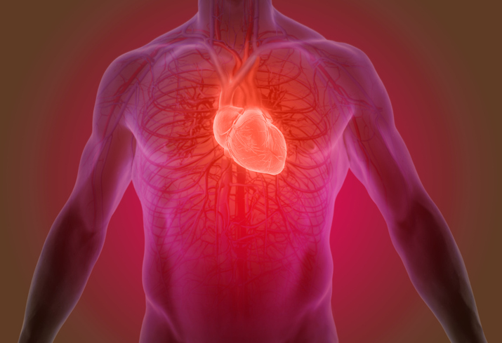 are-there-benefits-of-cardiac-catheterization-for-stable-coronary-artery-disease?